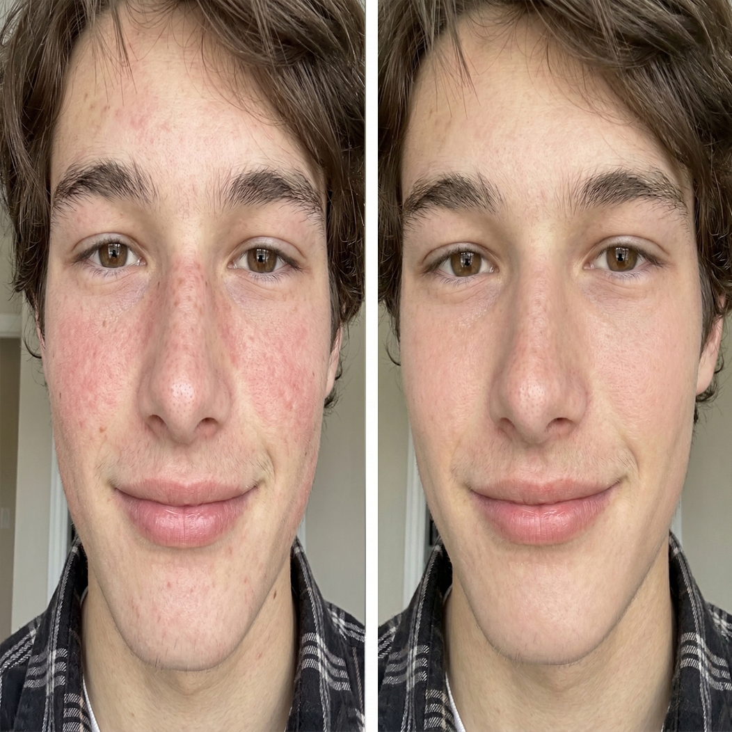 Before and after