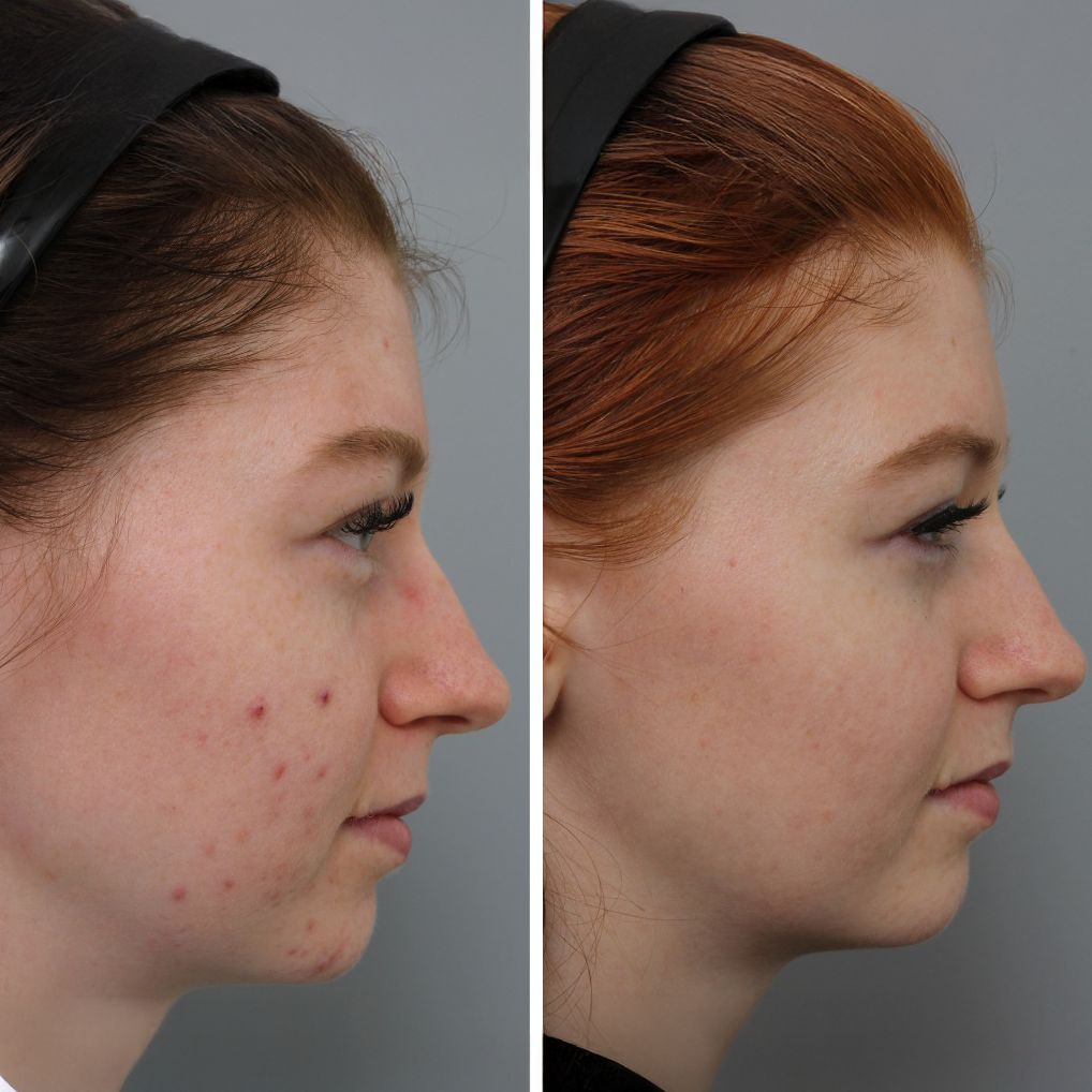 Before and after