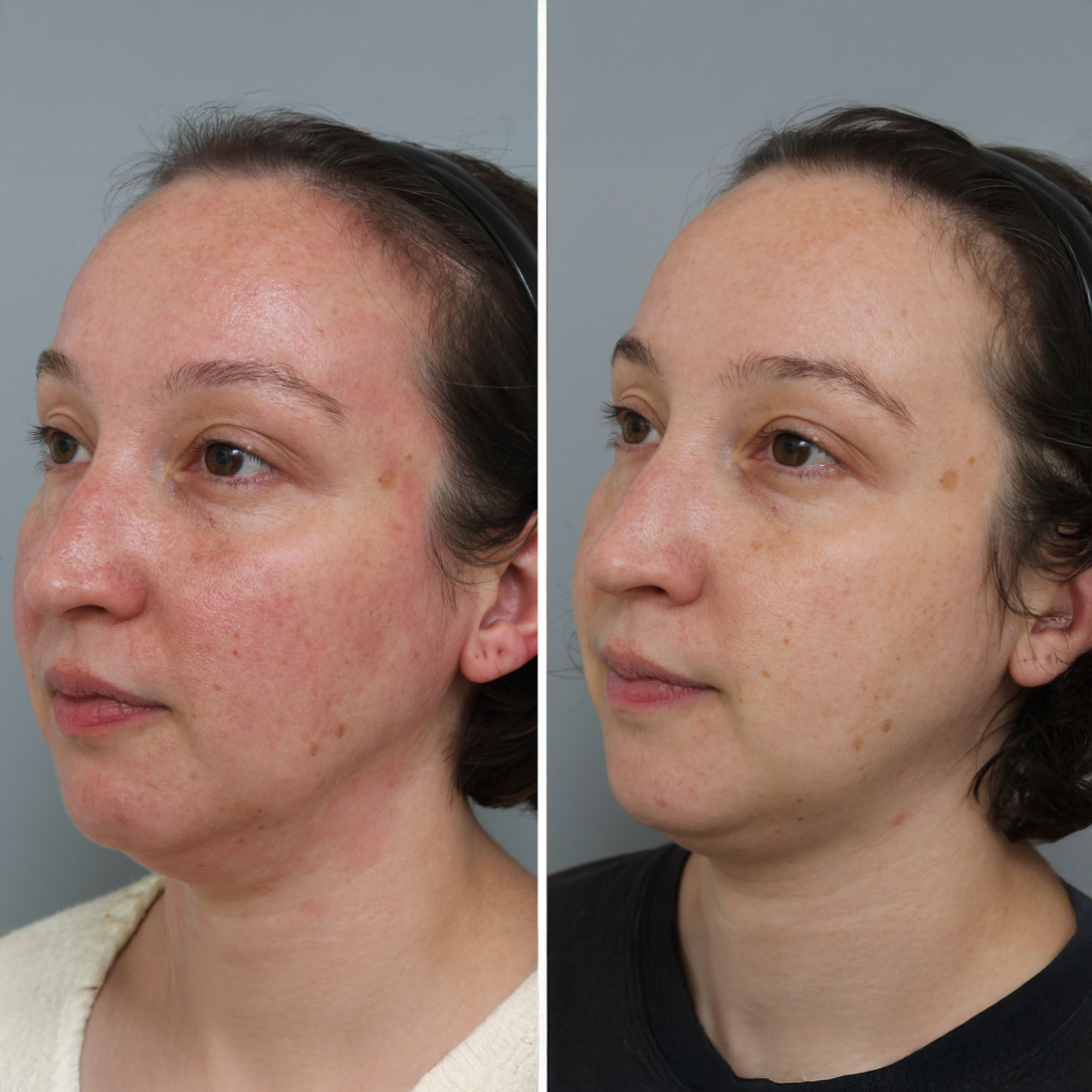 Before and after