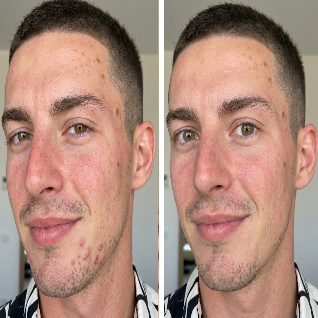Before and after